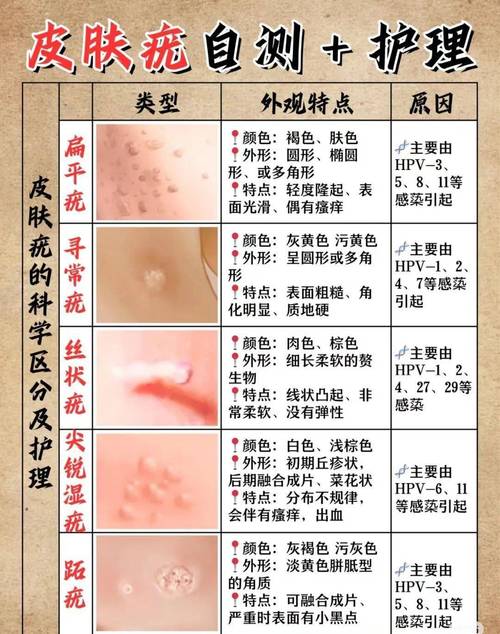 HPV18 阳性，长日光阴该如何应对？